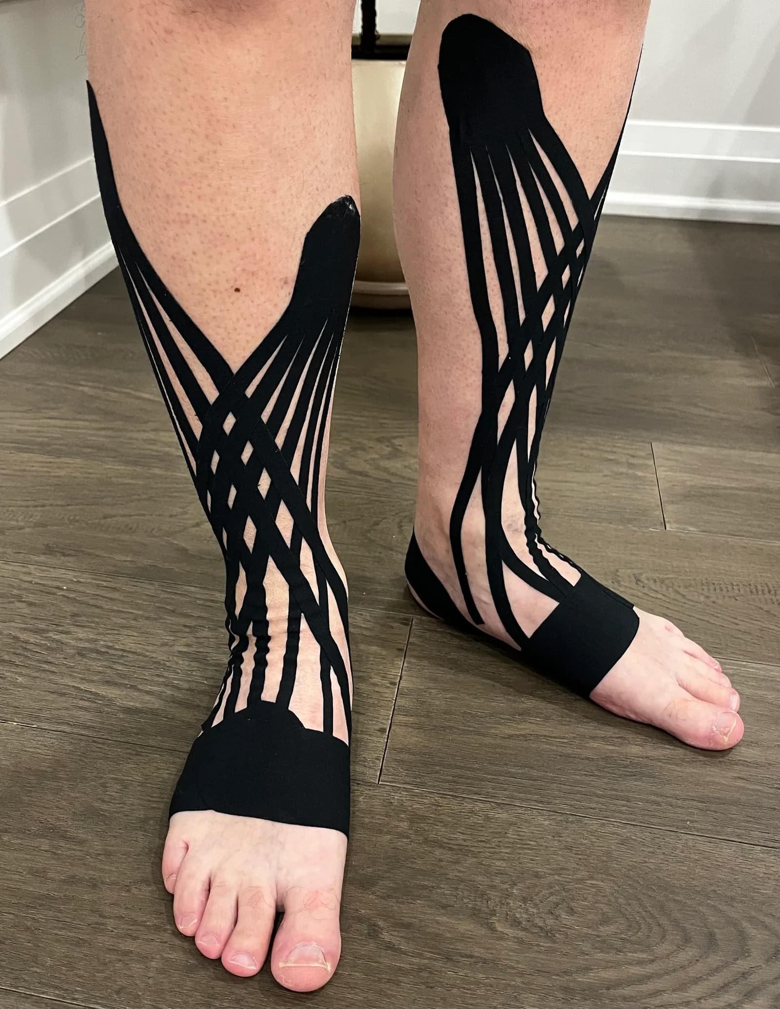 Black kinesio taping applied in a web pattern on a client’s calves and ankles